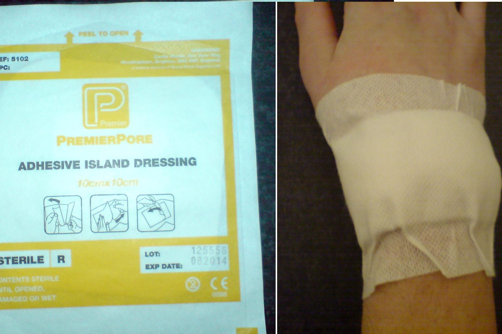 An adhesive dressing used to cover a wound.